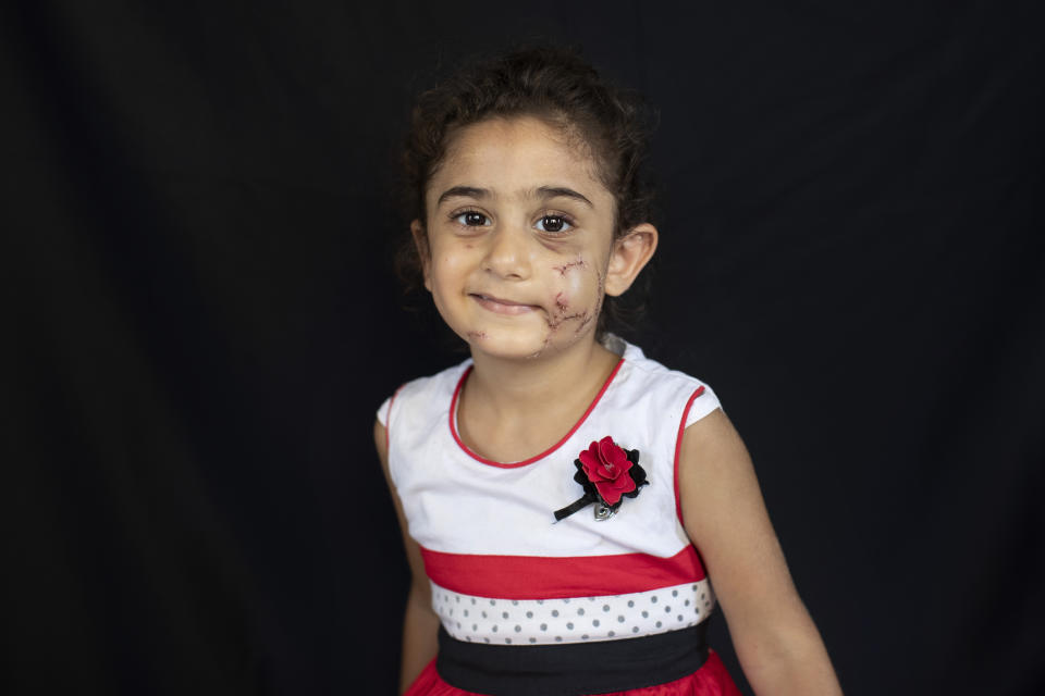 Yara Saeid, 4, who got injured at her parents' apartment during the Aug. 4 explosion that killed more than 170 people, injured thousands and caused widespread destruction, poses for a photograph in Beirut, Lebanon, Thursday, Aug. 13, 2020. (AP Photo/Hassan Ammar)