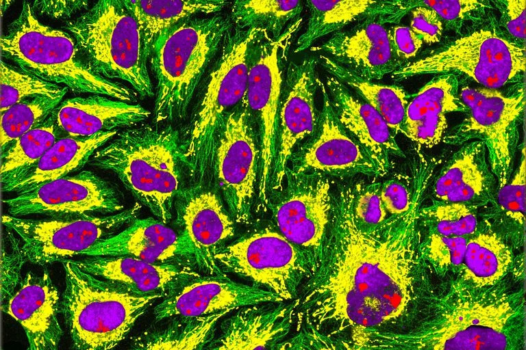 Inmunofluorescencia de células HeLa, piezas claves para el avance de la medicina