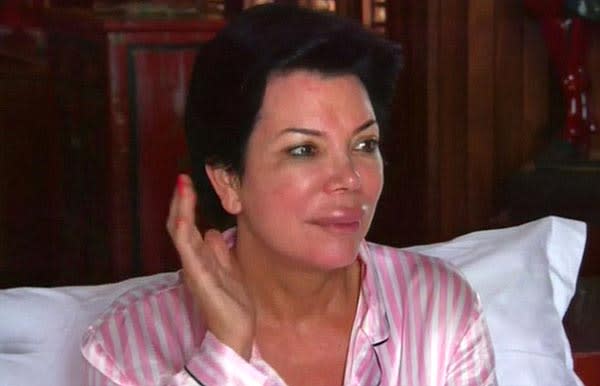 ‘Keeping Up With The Kardashians’ Preview: Kris Jenner Gets Giant Inflated Lips