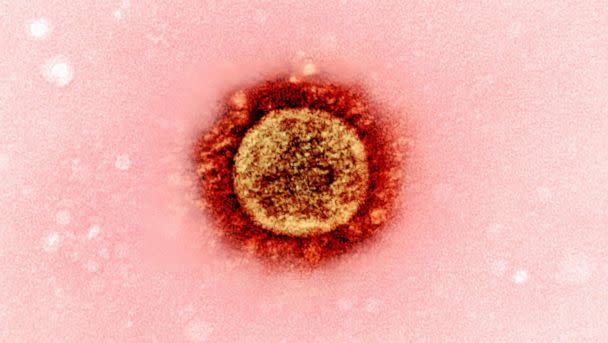 PHOTO: Transmission electron micrograph of a SARS-CoV-2 virus particle (UK B.1.1.7 variant), isolated from a patient sample and cultivated in cell culture. Image captured at the NIAID Integrated Research Facility (IRF) in Fort Detrick, Md. (BSIP/Universal Images Group via Getty Images)