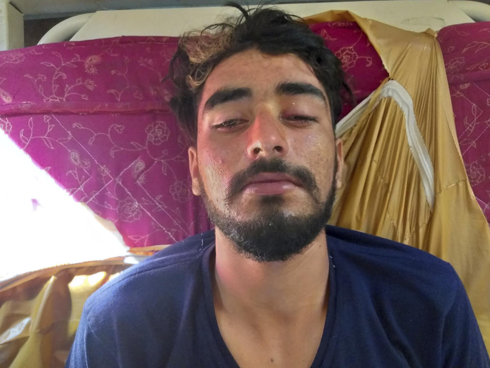 A Kashmiri man receives treatment for pellet injuries at the Shri Maharaja Hari Singh (SMHS) hospital in Srinagar, Indian controlled Kashmir, Thursday, Aug. 8, 2019. Tens of thousands of government forces in riot gear patrol Indian-controlled Kashmir. Streets lined with shuttered shops are deserted, steel barricades and razor wire cutting off neighborhoods. At the SMHS hospital, doctors told The Associated Press on Thursday that at least 50 people had come in with wounds from pellet guns and rubber bullets, the ammunition security forces often use to disperse protests. (AP Photo/Sheikh Saaliq)