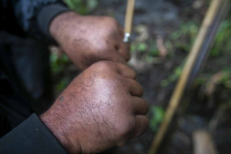 Nepalese honey hunter Devi Bahadur Nepali, shows his hands swollen after being stung by bees while harvesting in Dolakha, 115 miles east of Kathmandu, Nepal, Nov. 20, 2021. High up in Nepal's mountains, groups of men risk their lives to harvest much-sought-after wild honey from hives on cliffs. (AP Photo/Niranjan Shrestha)