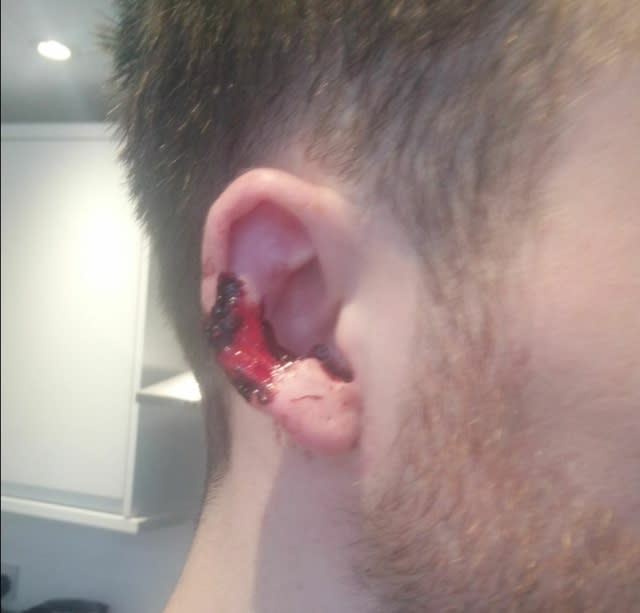 Man's ear bitten in train attack