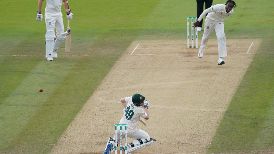 Steve Smith, pictured here after he was struck on the neck. (Photo by Jed Leicester/Getty Images)