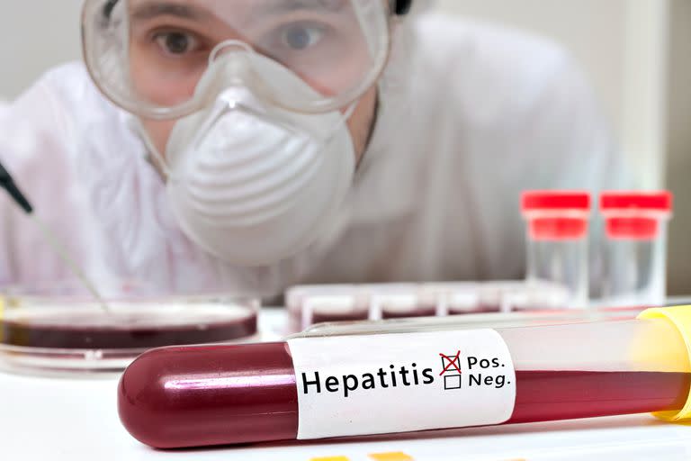Hasta el momento se conocen unos 450 casos en el mundo de esta hepatitis