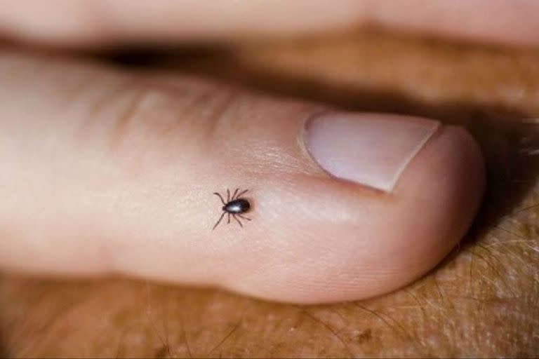 La enfermedad de Lyme se contra por la picadura de garrapatas