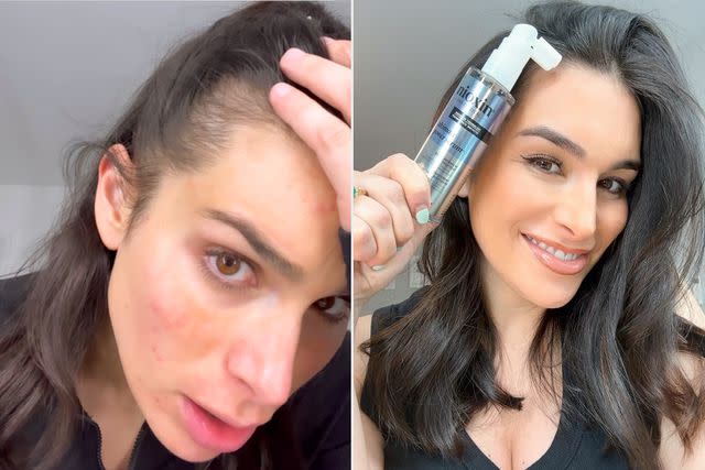 <p> Ashley Iaconetti</p> Iaconetti before Nioxin Ultimate Power Serum (left) and after (right)