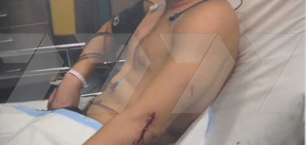 The victim was stabbed in his stomach, arm and neck. Photo: Supplied