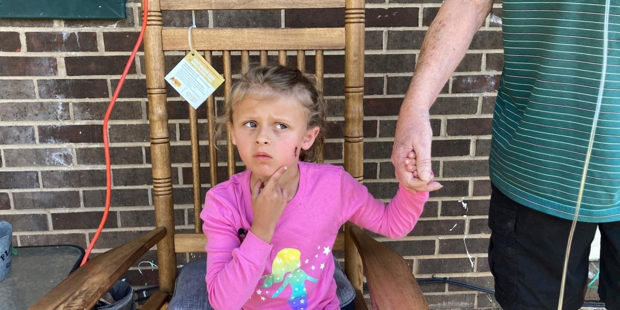 Kinsley White, 6, in a pink shirt points to her face to show where she was wounded.