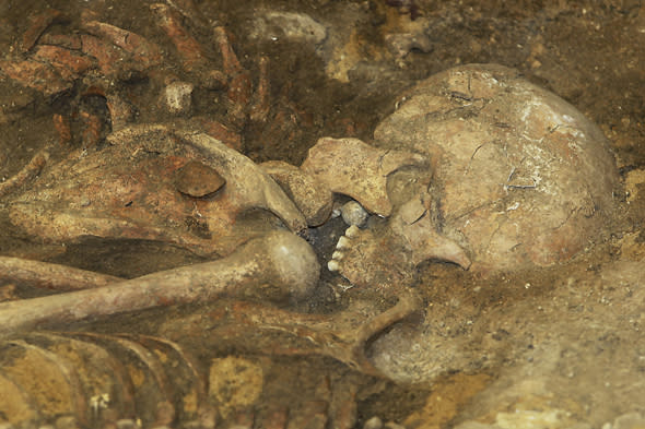 Mandatory Credit: Photo by Action Press/REX (3435286c)Musket ball in the mouth of a skullMass grave discovered at site of Battle of L?tzen in the Thirty Years' War, Saxony-Anhalt, Germany - 10 Dec 2013Archaeologists from the State Office for historic preservation of Saxony Anhalt have been excavating a mass grave at the site of the Battle of L?tzen, the pivotal encounter in the Thirty Years War.The crew unveiled the first tangible evidence in military history of the use of snipers in the Thirty Years' War, as two skulls were discovered with musket balls in the oral cavities - where snipers used to hold their ammunition while firing and reloading.