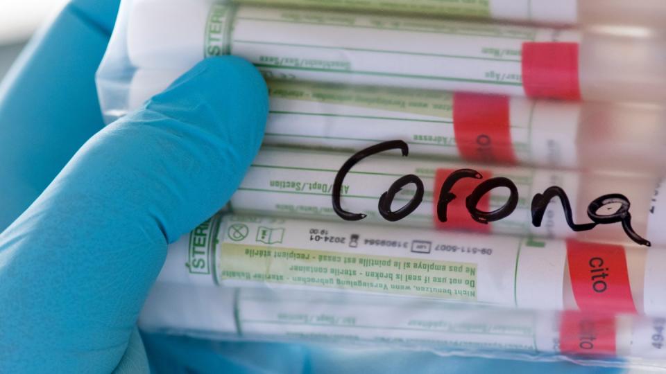 Die Post will mehreren Tausend Angestellten Corona-Tests anbieten - das bleibt in Unternehmen wohl eher die Ausnahme.