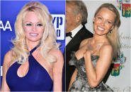 <p>At 49, Pamela Anderson is a complete knockout. The former “Baywatch” babe looked fresh-faced and youthful as she opted for a no-makeup-makeup look at the 40th Best Award Ceremony in Paris. She pulled her iconic blonde locks out of her face and smiled girlishly all night (photo R). A vast difference from the heavy liner and over-plucked brows she used to favour (photo L). Click through the gallery to see more awesome celeb makeunders! <i> (Photos: Getty, 2015/2017) </i> </p>