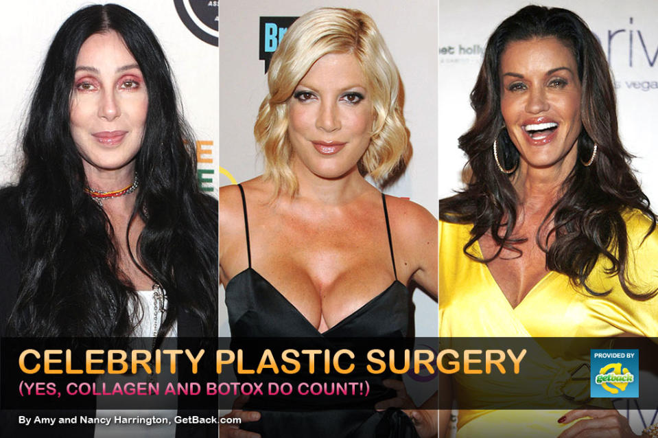 titlecard omg celebrityplasticsurgery