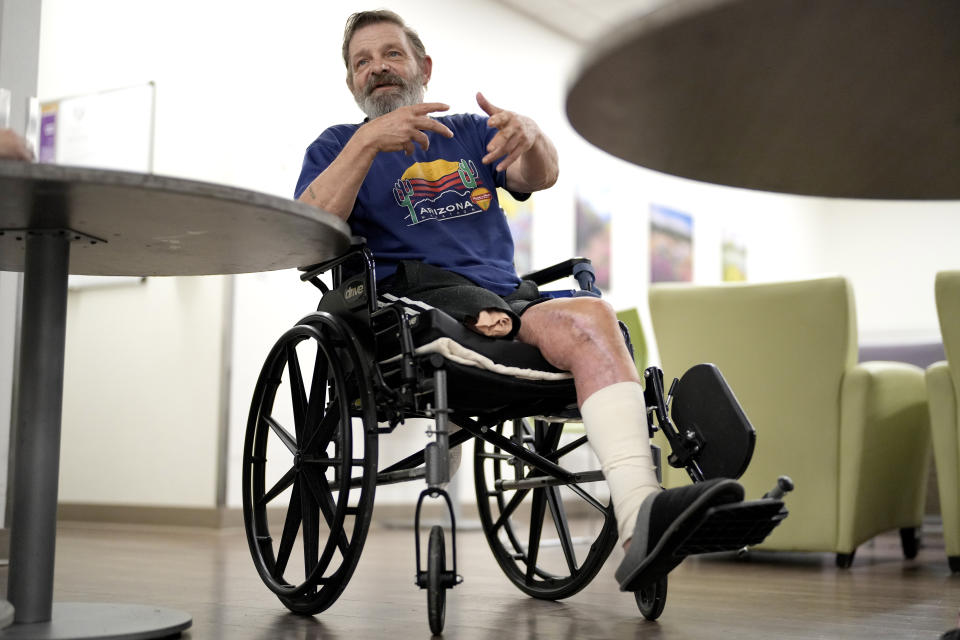 Ron Falk, 62, speaks of losing his leg, Tuesday, June 25, 2024 in Phoenix. Falk lost his right leg, had extensive skin grafting on the left one and is still recovering a year after collapsing on the searing asphalt outside a convenience store where he stopped for a cold soda during a blistering heat wave. (AP Photo/Matt York)