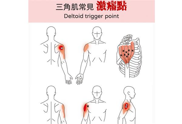 （圖片提供／侯鐘堡醫師By復健醫學會）