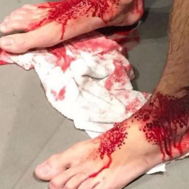 Sam's legs were left bleeding after a post-footy swim. Source: Seven News