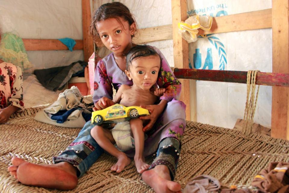 Displaced Yemeni children in desperate need of medical treatment and food (AFP via Getty Images)