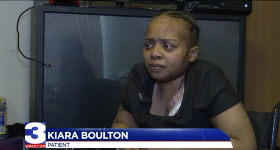 Mother-of-three Kiara Boulton had her leg amputated after a spider bite. Source: WREG Memphis News Channel 3