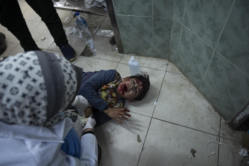 A Palestinian child wounded in the Israeli bombardment of the Gaza Strip is brought to Al Najjar hospital in Rafah, Gaza Strip, Saturday, Feb. 24, 2024. (AP Photo/Fatima Shbair)