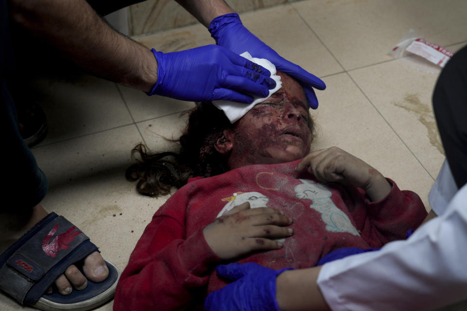 Una niña palestina herida por un bombardeo israelí en la Franja de Gaza es atendida en un hospital, el martes 14 de noviembre de 2023, en Deir al-Balah. (AP Foto/Hatem Moussa)