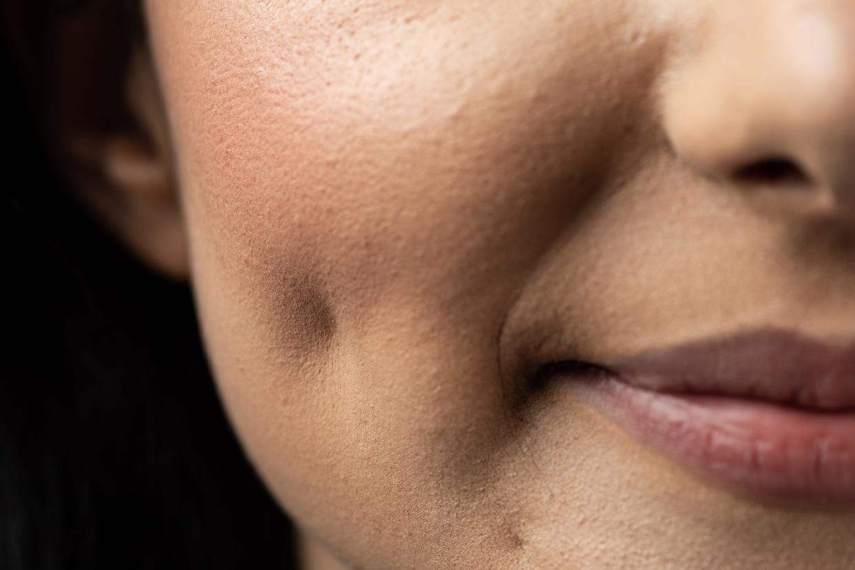 The latest TikTok craze? "Dimple makers," or small devices meant to give you a dimpled look.