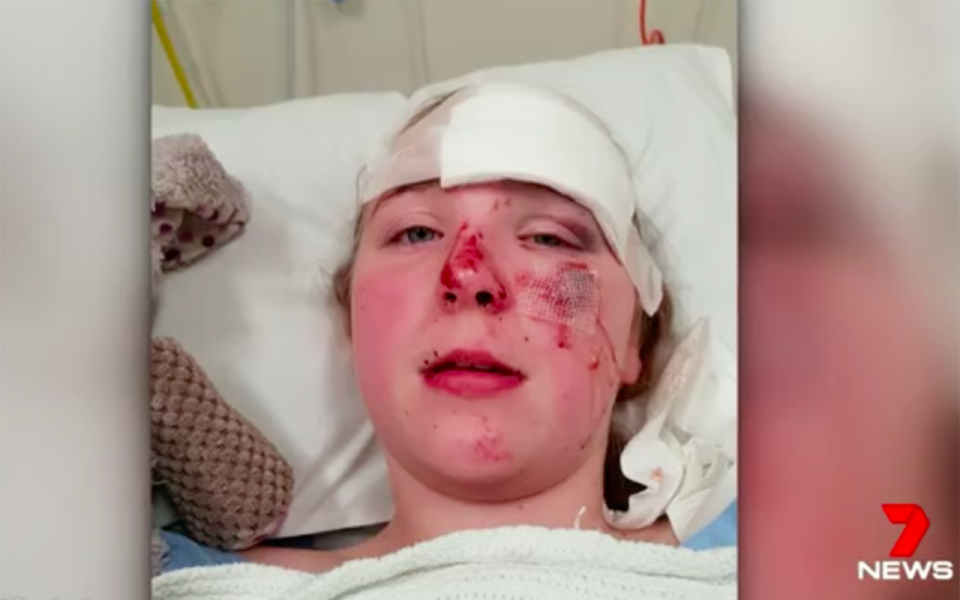 Jayla Wallace, 13, is grazed and bruised after saving her little nephew’s life. Source: 7 News