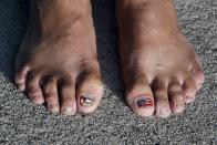 A Cuban migrant shows her toes decorated with the flags of Cuba (L) and the United States at a temporary shelter in a school in the town of La Cruz, Costa Rica, near the border with Nicaragua, November 17, 2015. More than a thousand Cuban migrants hoping to make it to the United States were stranded in the border town of Penas Blancas, Costa Rica, on Monday after Nicaragua closed its border on November 15, 2015 stoking diplomatic tensions over a growing wave of migrants making the journey north from the Caribbean island. REUTERS/Juan Carlos Ulate