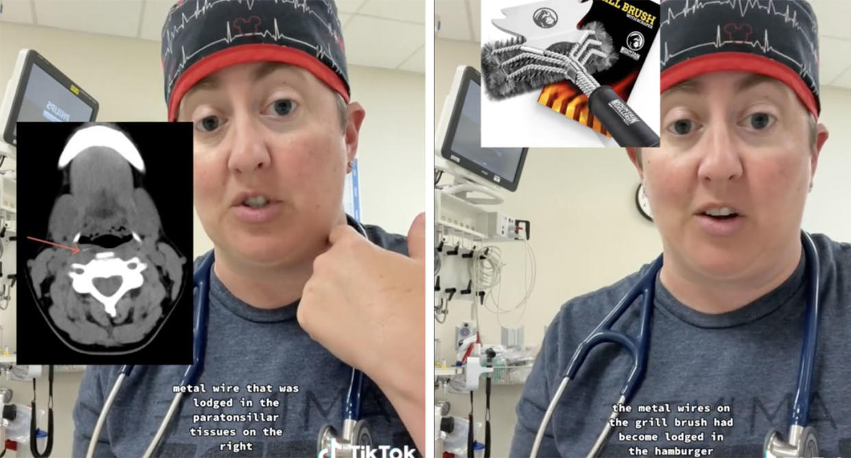 Can a BBQ brush send you to the ER? A viral TikTok is warning of the dangers of this common summer item.
