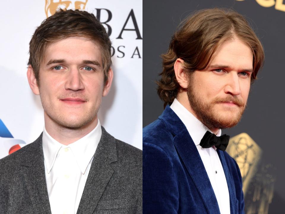 Bo Burnham with short hair on the left and long hair on the right