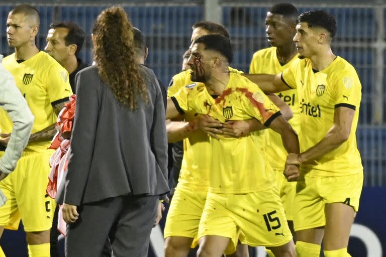 El defensor Maximilaino Olivera, de Peñarol, reacciona con el rostro ensangrentado, tras la agresión de un hincha de Rosario Central en el Gigante de Arroyito; Por eso, el conjunto rosarino recibió una fuerte sanción