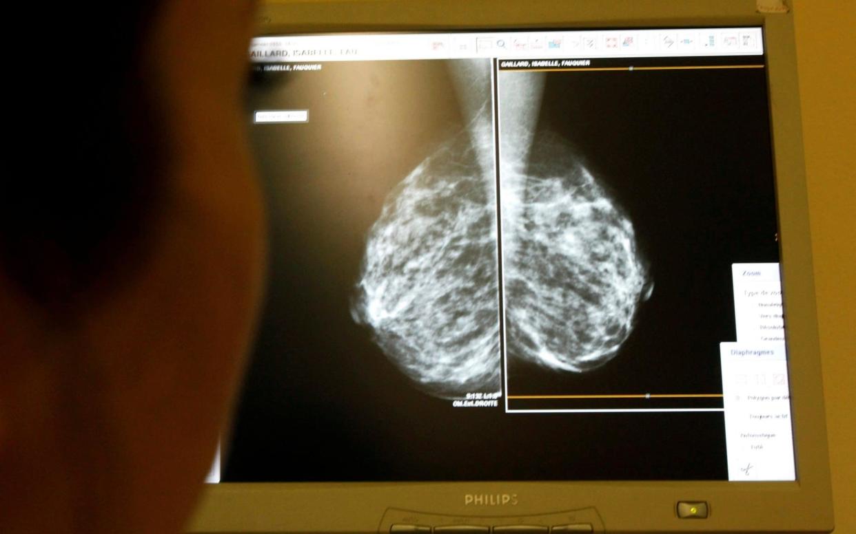 A woman undergoes a mammograms, a special type of X-ray of the breasts -  REUTERS