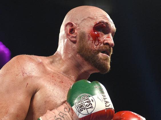 Fury suffered a deep cut above his eye in his fight with Wallin (Getty)