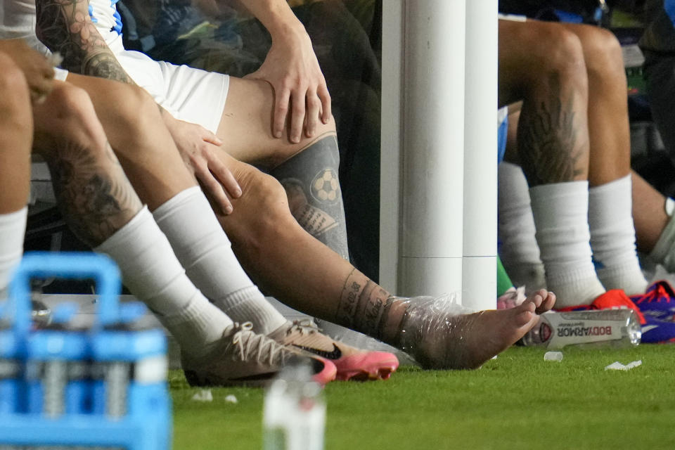 El atacante argentino Lionel Messi con su tobillo derecho hinchado cubierto por hielo en la banca durante la final de la Copa América, el domingo 14 de julio de 2024, en Miami Gardens, Florida. (AP Foto/Julio Cortez)