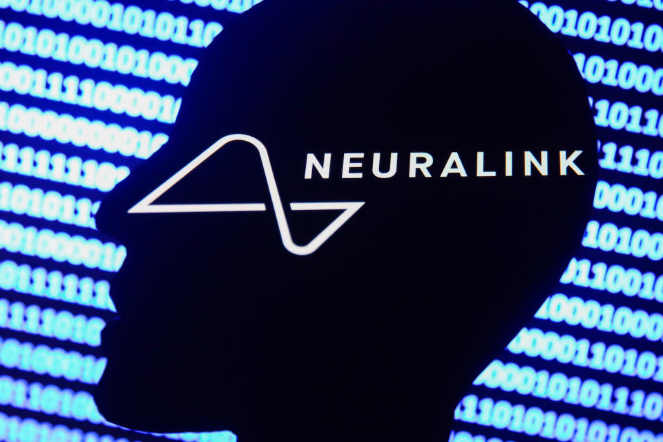 Neuralink logo displayed on a phone screen, a silhouette of a paper in shape of a human face and a binary code displayed on a screen are seen in this multiple exposure illustration photo taken in Krakow, Poland on December 10, 2021. (Photo by Jakub Porzycki/NurPhoto via Getty Images)