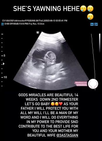 <p>TRON AUSTIN/ Instagram</p> Chili's son Tron Austin shares ultrasound sound photo on Instagram after revealing that he will be a father.