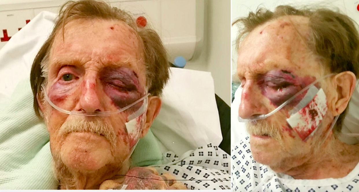 <em>Arthur ‘Bob’ Gumbley was brutally attacked and robbed at his home on Tuesday night (SWNS)</em>