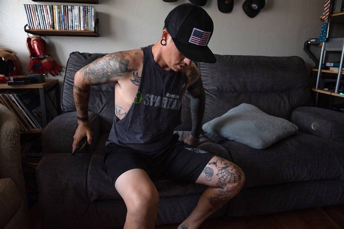 Casey Rich moves with caution as he recovers from wounds suffered when he was stabbed 10 times by a DoorDash driver at a McDonald’s restaurant in Ceres. Rich suffered a punctured lung in the altercation and is recovering at his home in Ceres, Calif., on Thursday, August 4, 2022.