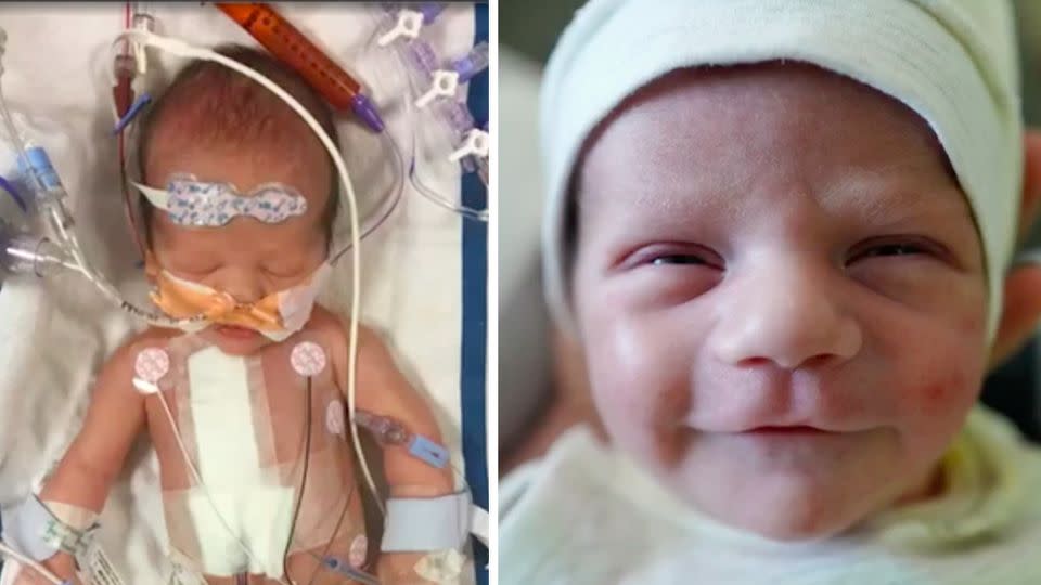 Little Billy Kimmel underwent life saving heart surgery, coming out smiles on the other end. Source: Jimmy Kimmel Live