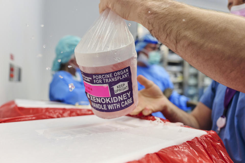 In this photo provided by NYU Langone Health, a gene-edited pig kidney with thymus is removed from its transport container to be prepared for transplantation at the hospital in New York on April 12, 2024. Doctors transplanted a pig kidney into a patient, who was near death, part of a dramatic pair of surgeries that also included a fix for her failing heart. (Joe Carrotta/NYU Langone Health via AP)