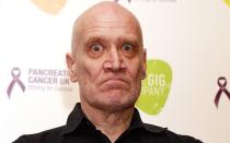 <p>Als Gitarrist und Gründungsmitglied der britischen Rockband Dr. Feelgood schrieb Wilko Johnson Musik-, als königlicher Henker Ser Ilyn Payn in "Game of Thrones" TV-Geschichte: Bereits 2013 war bei Wilko Johnson Bauchspeicheldrüsenkrebs diagnostiziert worden, am 21. November erlag er den Folgen der Krankheit. Johnson wurde 75 Jahre alt. (Bild: Jo Hale/Getty Images)</p> 