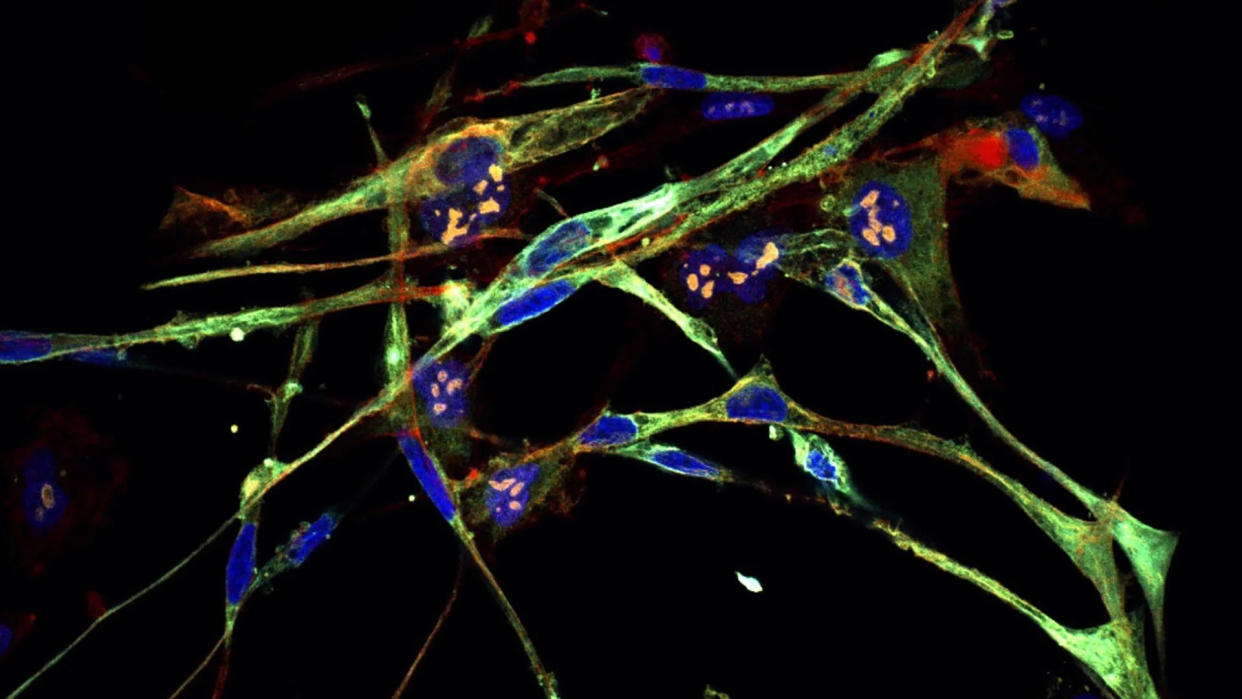  spindle-shape muscle cells shown depicted in bright green and blue against a black background 