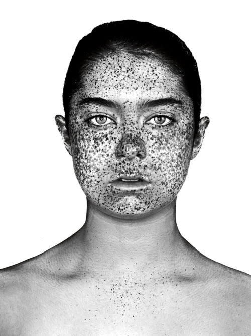 The artist’s goal is to shoot 150 diverse portraits of freckled faces