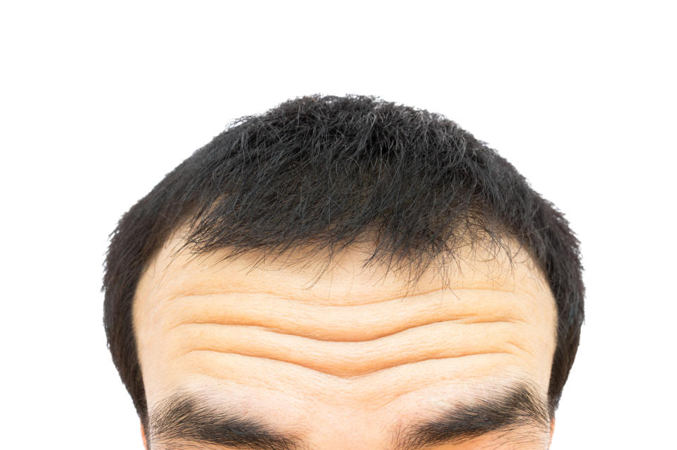 <em>Risky wrinkles – research suggests people with deeper forehead wrinkles than typical for their age have a higher risk of dying of cardiovascular disease (Picture: Getty)</em>