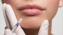 <p>Scary surgery trend: lip reductions are now a thing</p>