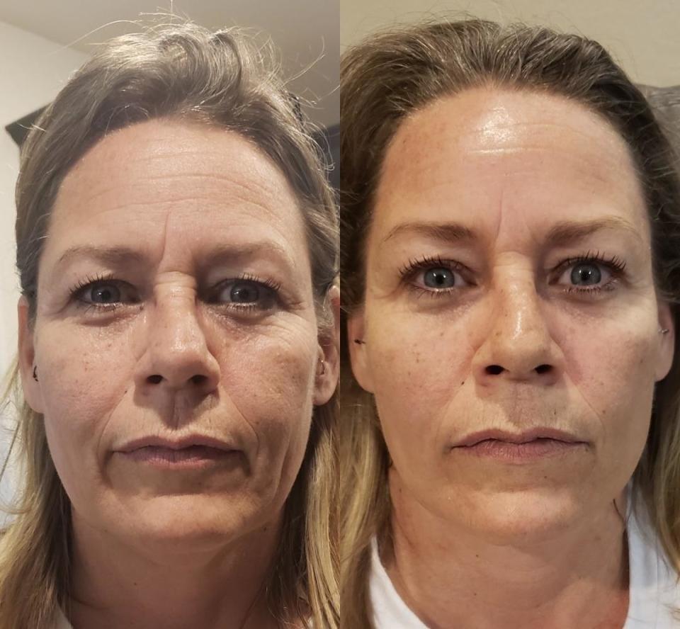 Reviewer before and after showing the mask made their skin look tighter and reduced the appearance of some wrinkles