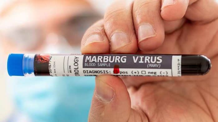 Ghana en alerta por el virus de Marburgo - El Comercio