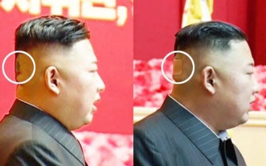 Kim Jong-un