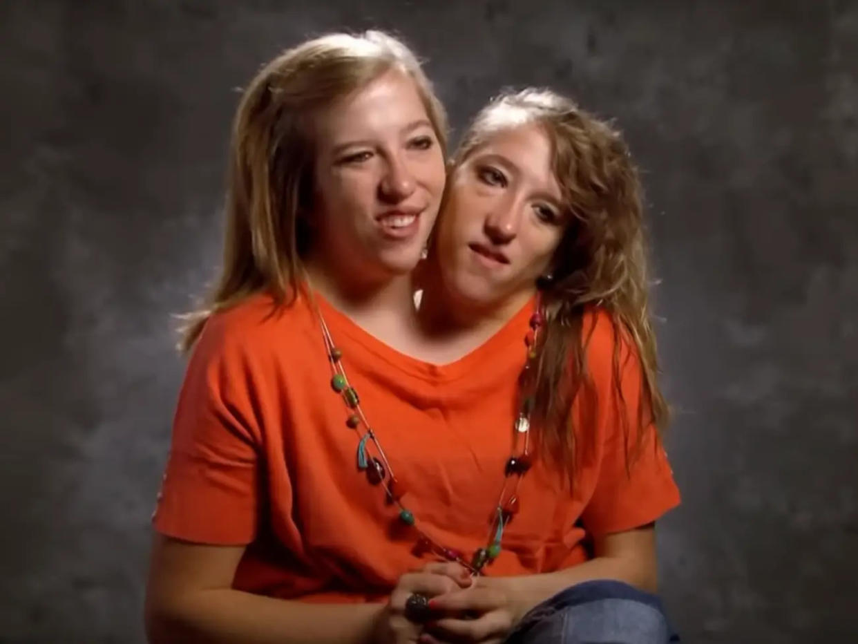 Die siamesischen Zwillige Abby und Brittany Hensel  - Copyright: TLC