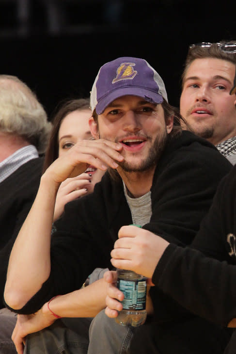 He is one helluva handsome guy, but Ashton Kutcher too has a deformity. He has webbed feet like that of a duck.