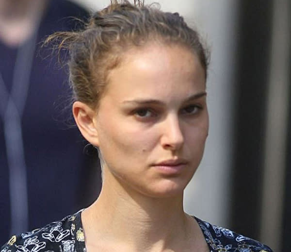 <p>Natalie Portman a révélé qu’elle était devenue vegan. Elle a donc arrêté de consommer des produits laitiers et des œufs. Résultat : ses éruptions cutanées ont disparu. <em>« Cela a été une découverte pour moi »</em>, a-t-elle déclaré au magazine <em>The Cut</em>.<br> Crédit photo : Rex </p>